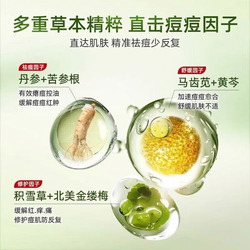 苦参祛痘霜正确用法是什么？-图3