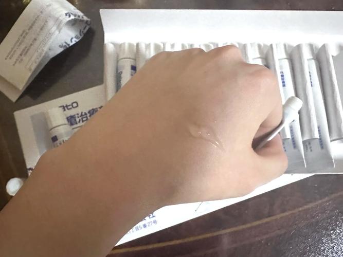 日本祛痘产品哪款最有效？-图2