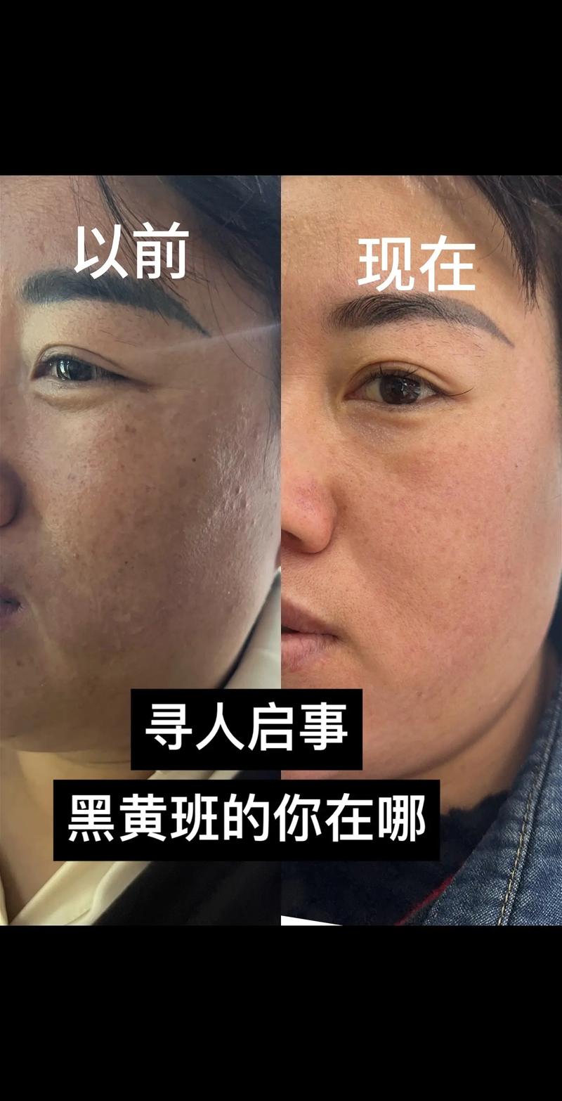 护肤品用后脸发黑是为什么？-图3