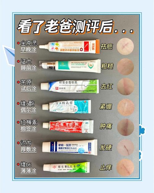 祛疤哪种方法最有效?-图3 祛疤哪种方法最有效?-图3