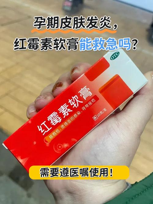 红是红霉素软膏，可祛痘乎？-图1