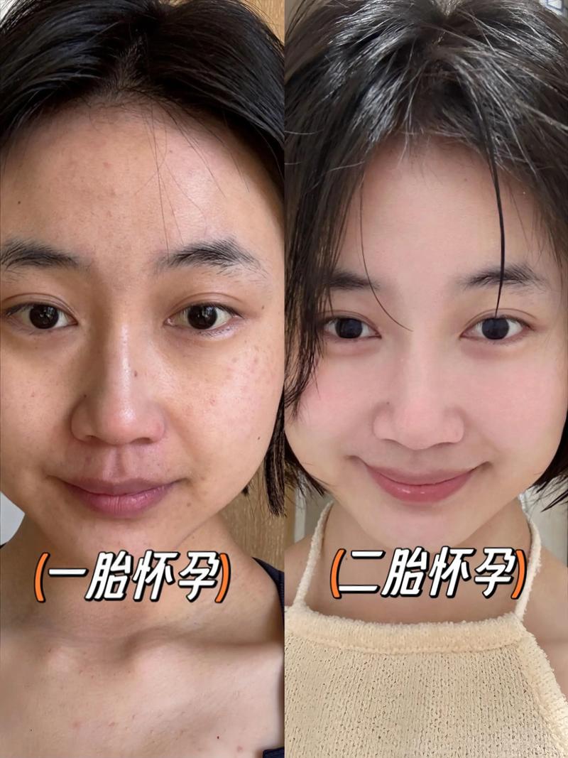 孕妇用护肤品对胎儿有影响吗？-图2