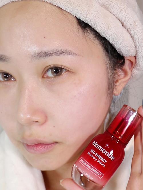 脂肪填充后护肤品怎么选？-图3