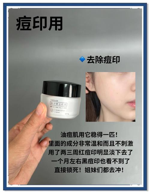 祛痘去毛孔，用什么产品好？-图3