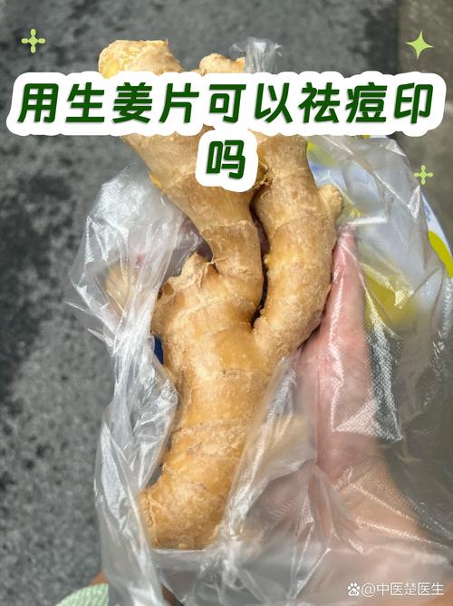 生姜敷脸真能祛痘吗?-图2 生姜敷脸真能祛痘吗?-图2