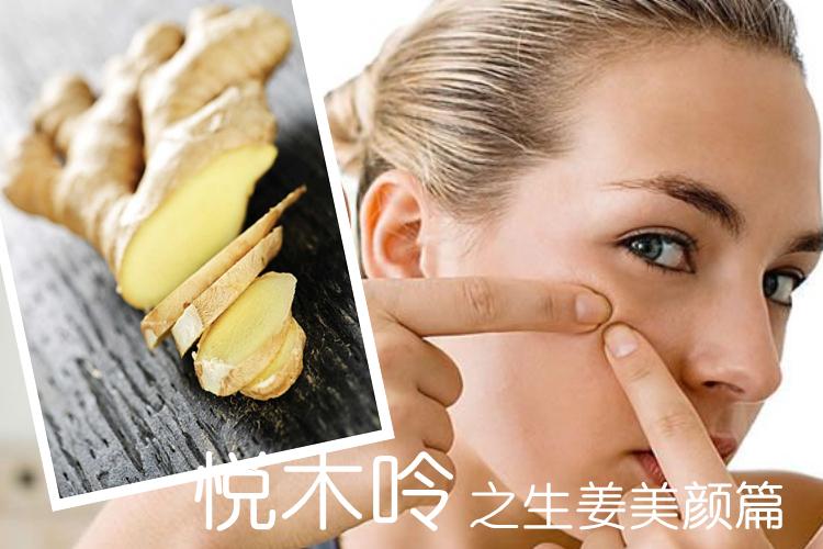 生姜敷脸真能祛痘吗?-图3 生姜敷脸真能祛痘吗?-图3