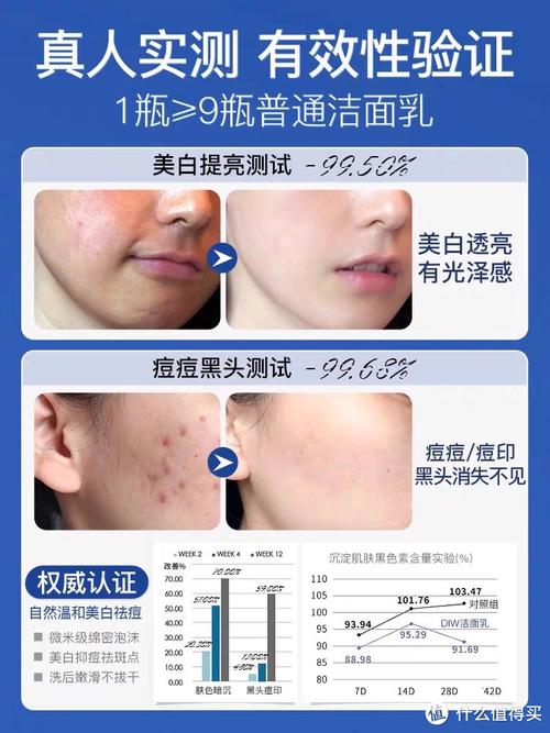 祛斑祛痘洗面奶真的有效吗?-图1 祛斑祛痘洗面奶真的有效吗?-图1