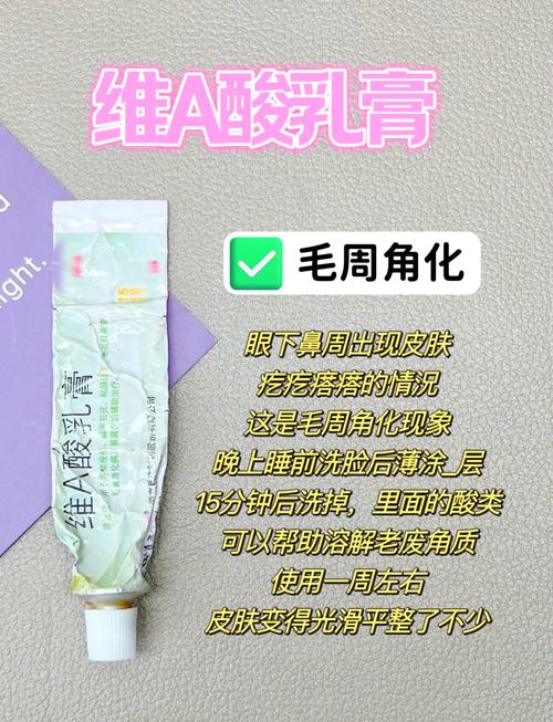 闭合性粉刺护肤品选哪个？-图2