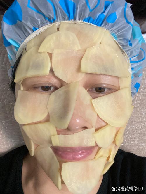 土豆敷脸祛痘多久能见效?-图1 土豆敷脸祛痘多久能见效?-图1