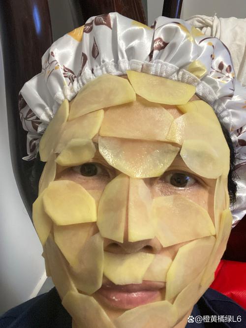 土豆敷脸祛痘多久能见效?-图3 土豆敷脸祛痘多久能见效?-图3