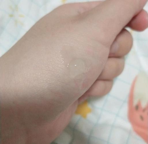 澳洲茶树祛痘凝胶味道刺鼻吗?-图2 澳洲茶树祛痘凝胶味道刺鼻吗?-图2