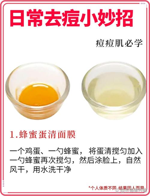 祛痘蜂蜜面膜怎么自制才有效?-图1 祛痘蜂蜜面膜怎么自制才有效?-图1