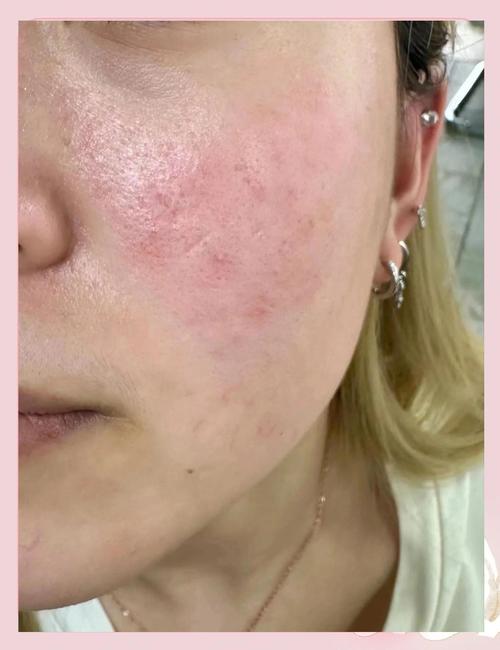 油敏肌怎么选护肤品？-图2