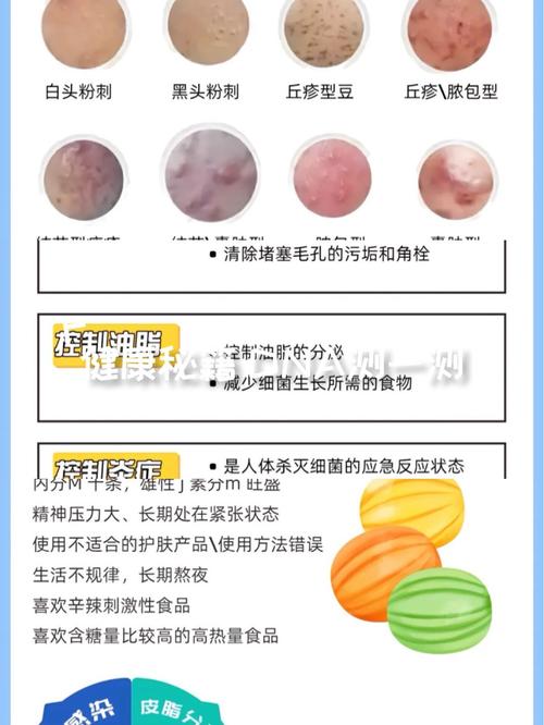 祛痘后如何护理不留痘印？-图1