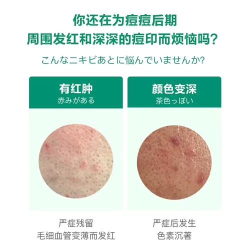 小林祛痘膏效果真的好吗？-图2