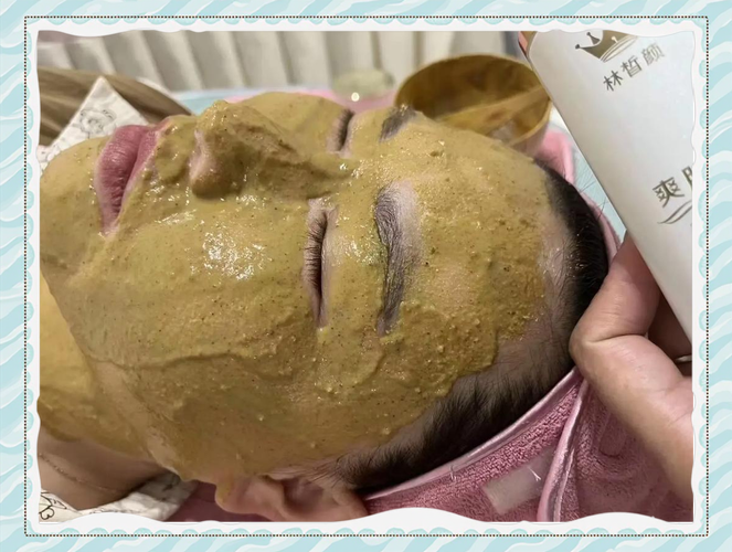 自制祛痘印面膜真的有效吗?-图2 自制祛痘印面膜真的有效吗?-图2