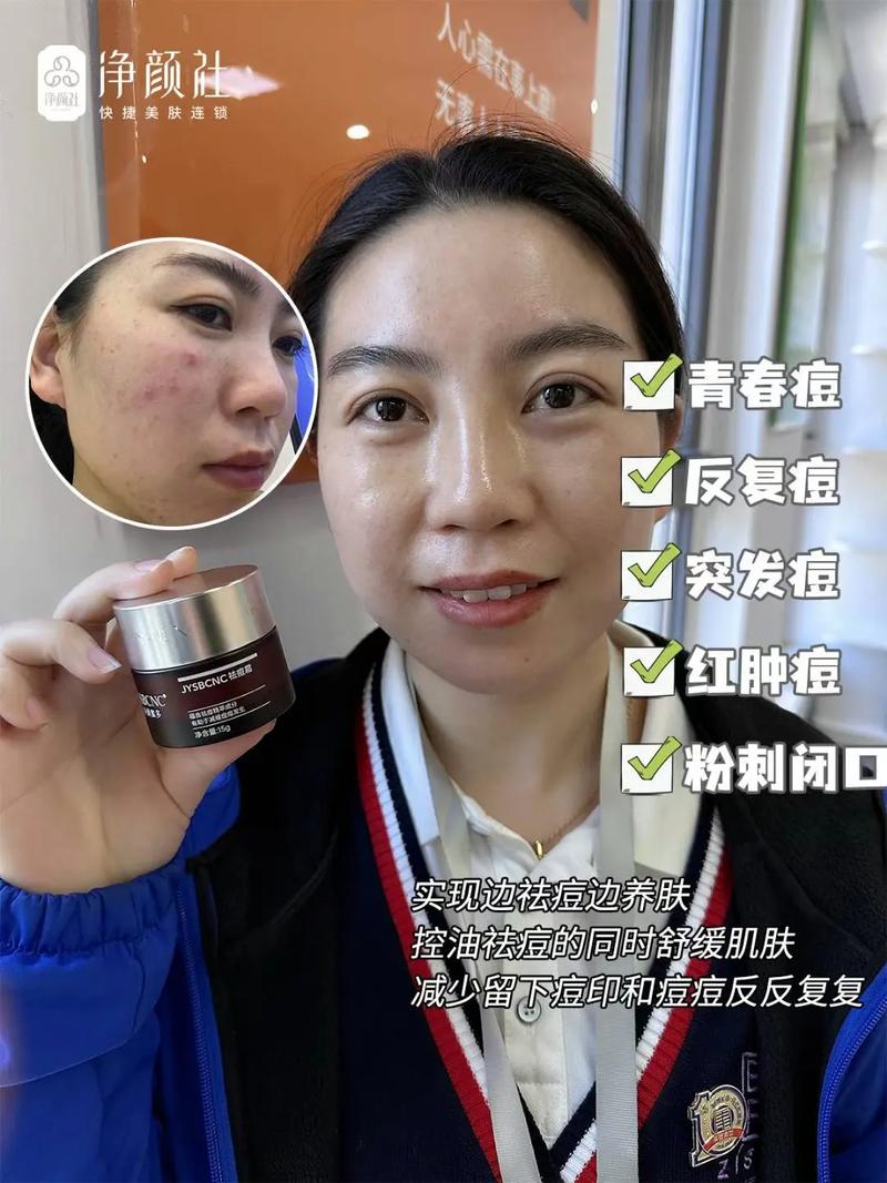 古痘净本草祛痘液官网是正品吗?-图3 古痘净本草祛痘液官网是正品吗?-图3