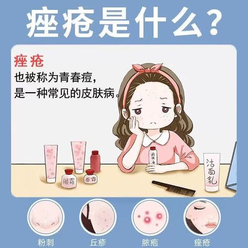 祛痘产品排毒期间会爆痘吗？-图2