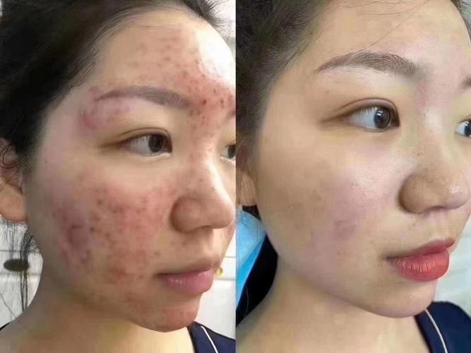 护肤VS不护肤，差距到底有多大？-图2