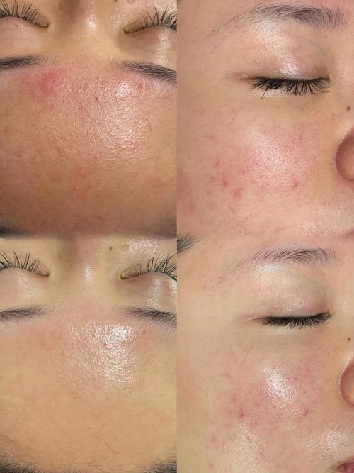 护肤VS不护肤，差距到底有多大？-图1