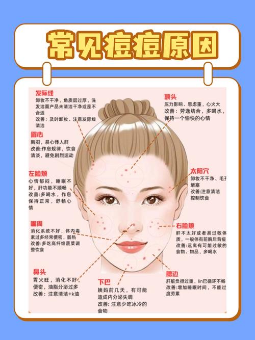 脸上长痘怎么排毒祛痘?-图3 脸上长痘怎么排毒祛痘?-图3