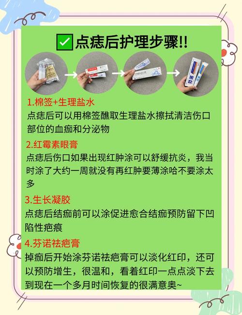 祛痣后多久能正常用护肤品？-图1