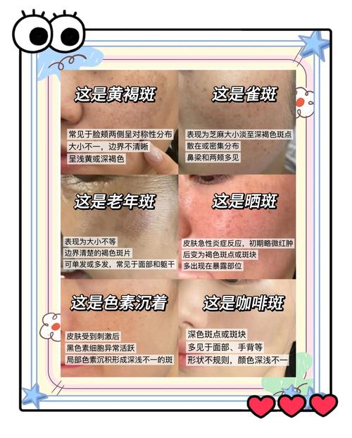 祛斑祛痘，哪种方法最有效？-图1