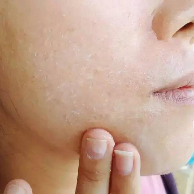 护肤品擦完脸粘粘的怎么办?-图1 护肤品擦完脸粘粘的怎么办?-图1