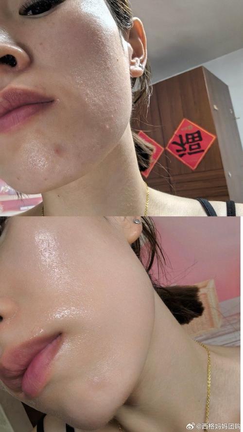 护肤品擦完脸粘粘的怎么办?-图2 护肤品擦完脸粘粘的怎么办?-图2