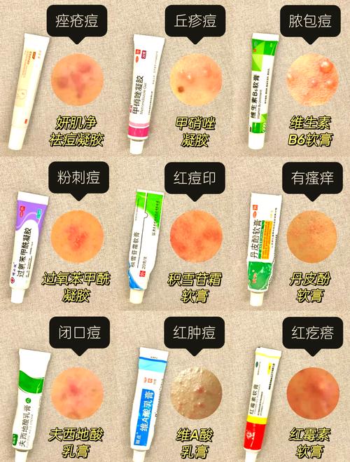 祛痘祛痘印产品怎么选才好用？-图1