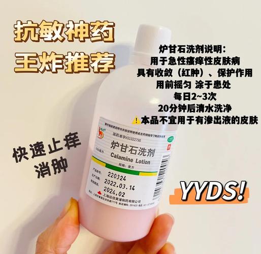 护肤品过敏后,该吃哪些药缓解?-图1 护肤品过敏后,该吃哪些药缓解?-图1