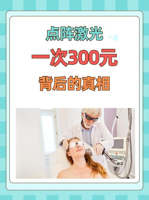 激光祛痘价格是多少？-图2
