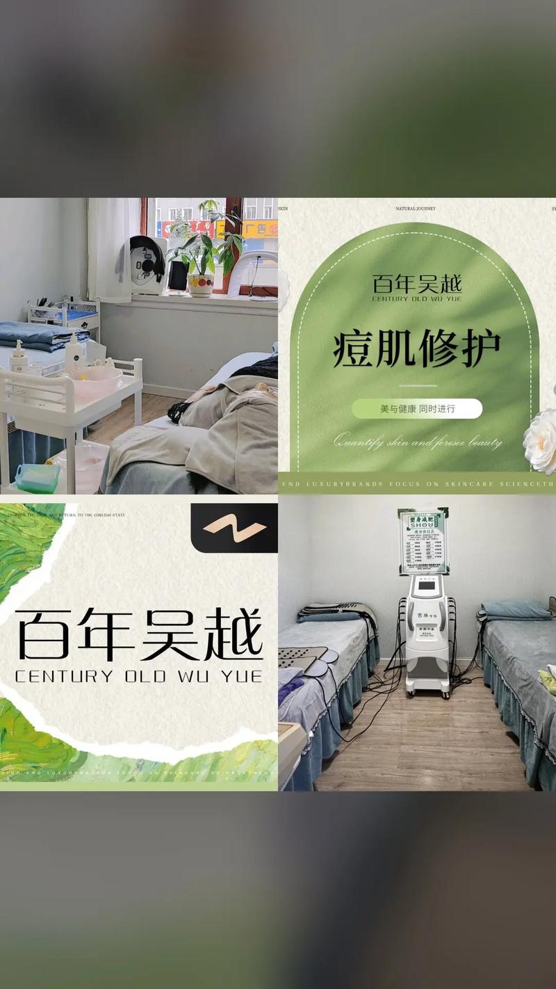 百年吴越祛痘印多少钱？效果好吗？-图1