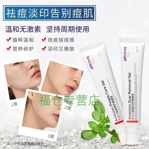 安美拉祛痘软膏价格是多少？-图1
