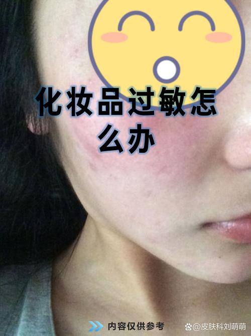 面部过敏护肤品怎么选？-图2