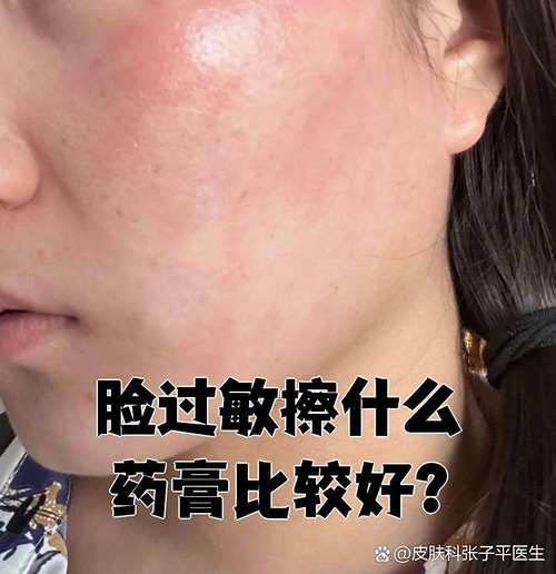 面部过敏护肤品怎么选？-图3