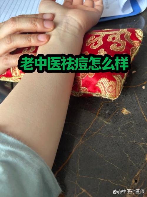 典豆祛痘效果到底行不行？-图2