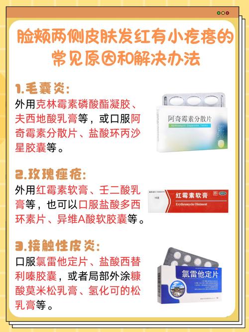 九红祛痘会依赖吗？-图1