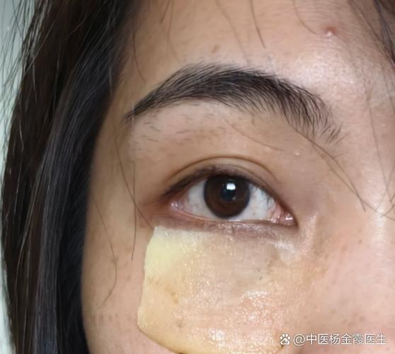 土豆片真能祛痘吗？-图3