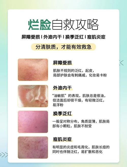 乱用护肤品脸会变差吗？-图2