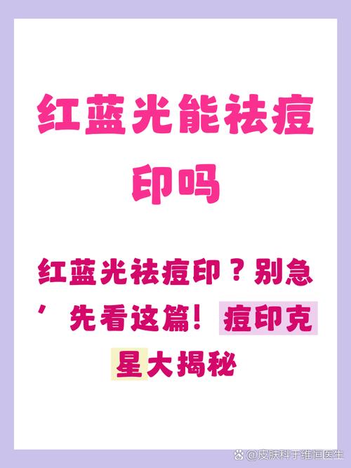 红蓝光祛痘有副作用么-图3