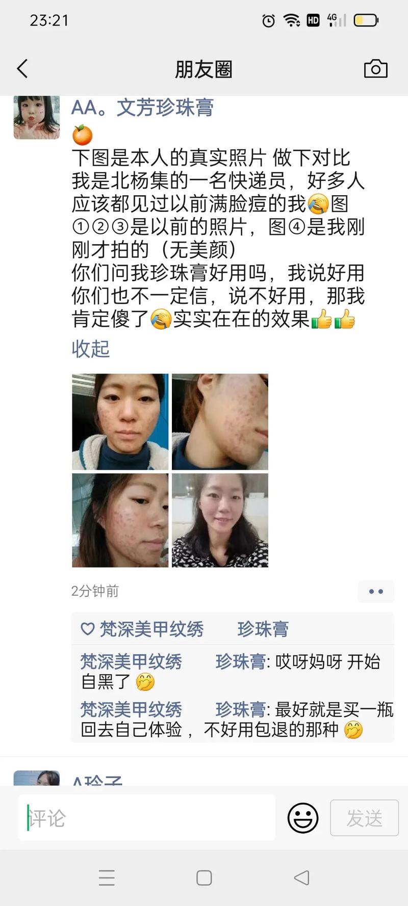 祛痘霜后能马上化妆吗？-图1