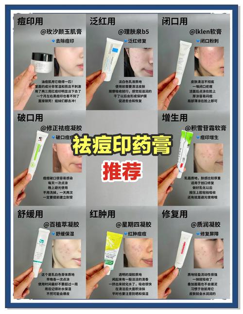 如何有效祛痘印？方法有哪些？-图1