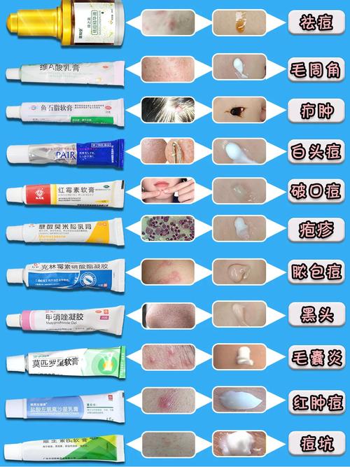 水源茶多芬祛痘膏多少钱一支？-图3