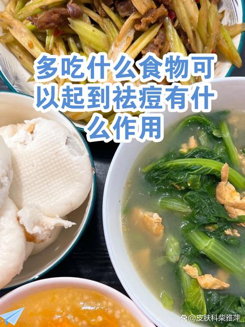 青少年祛痘该多吃啥？-图2