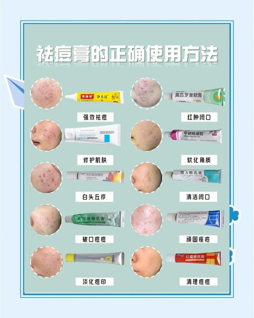 青少年祛痘该多吃啥？-图3
