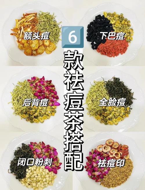 中药祛痘效果真的好吗？-图2