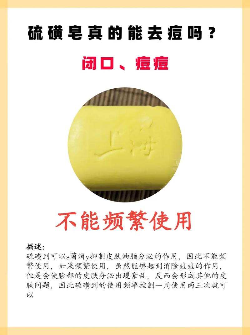 硫磺皂祛痘印真有效吗？-图1