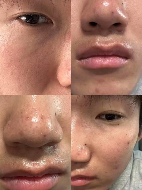 护肤品会导致畸形吗？-图2