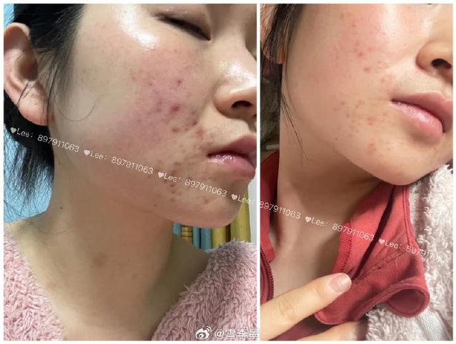 护肤品会导致畸形吗？-图3